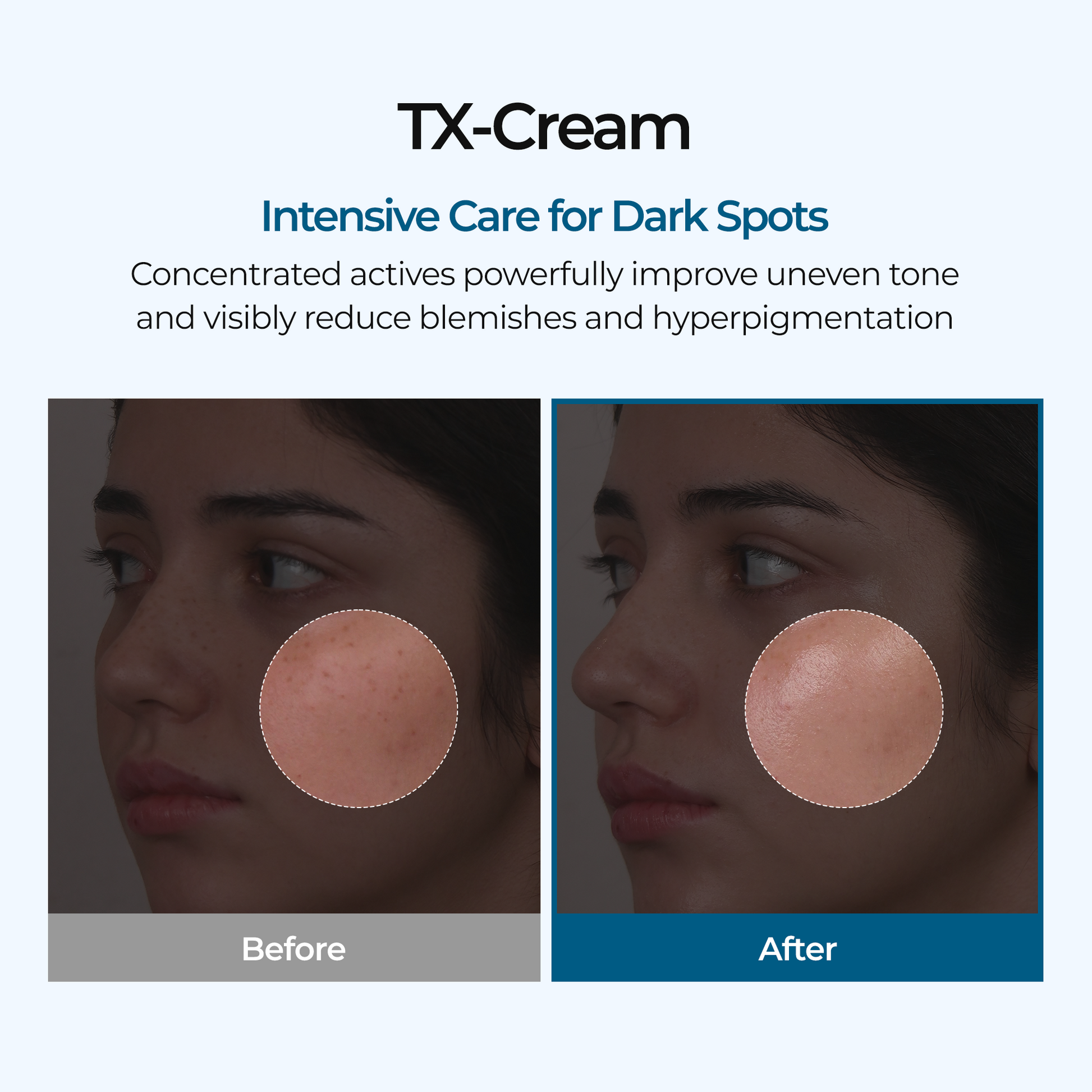 TX Cream